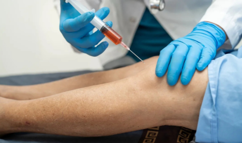 Stem Cell Treatment in London